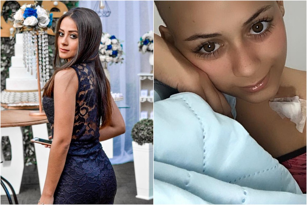 Fotos mostram o antes e depois de Isabella ser diagnosticada com câncer — Foto: Arquivo Pessoal