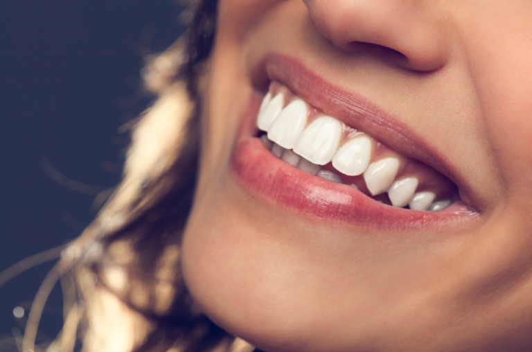 A importância da estética dos dentes para um sorriso bonito