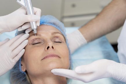 Rejuvenescimento facial alia diferentes técnicas