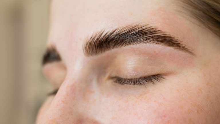 FUE Long Hair dá naturalidade ao transplante de sobrancelhas